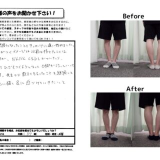 だんだんO脚が改善していくのがわかりました